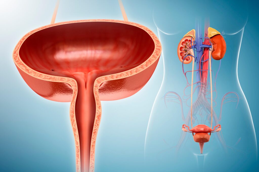 Bladder Cancer | Minimally Invasive Techniques