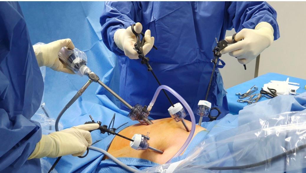 10,000 Laparoscopic Surgeries: Why Experience Matters in Modern Urology